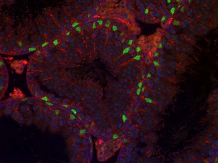 Transcriptional Control