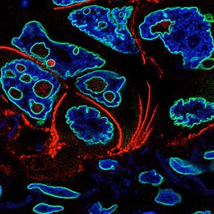 Micronuclei and Nuclear Envelope