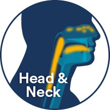 head and neck cancer