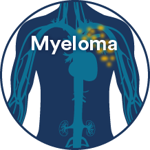 myeloma