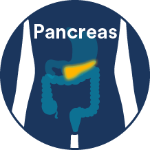 pancreatic cancer