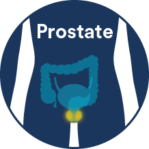 Prostate Cancers